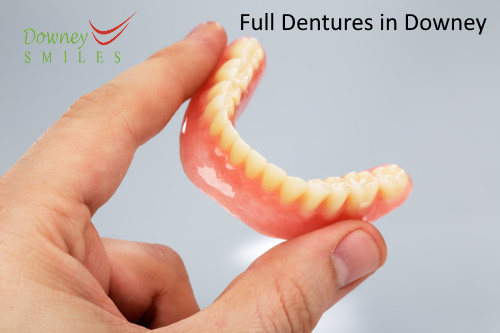 Complete Dentures in Downey