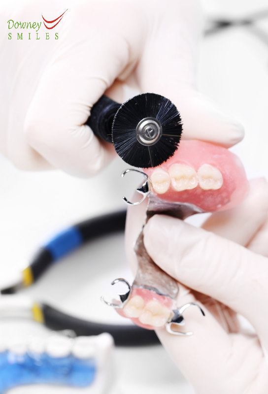 Metal Clasp Removable Partial Dentures