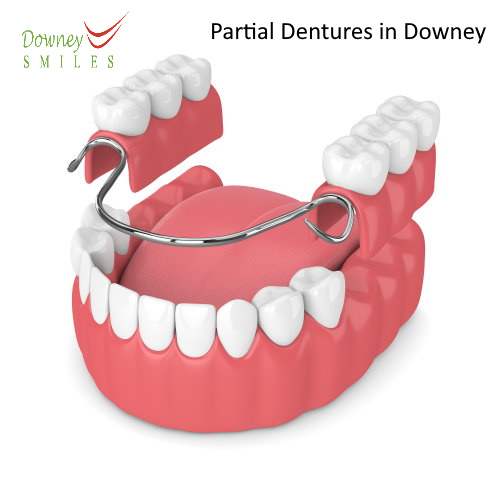 Partial Dentures in Downey