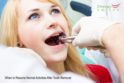 When to Resume Normal Activities After Tooth Removal